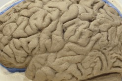 Le mystère de la formation des plis et replis de notre cerveau résolu