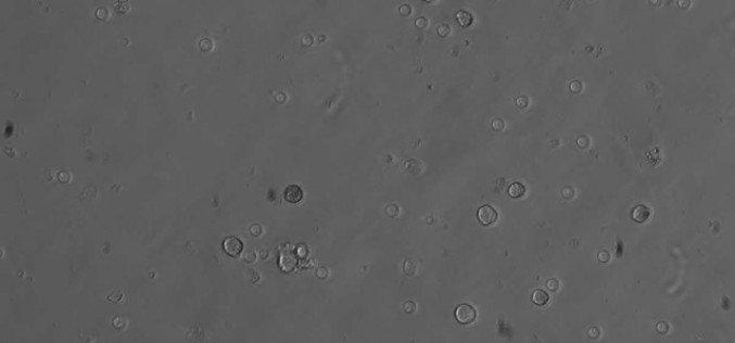Des scientifiques ont créé des spermatozoïdes artificiels capables de produire une descendance